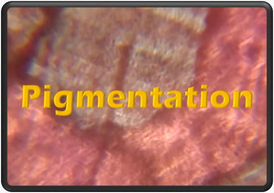 pigmentation